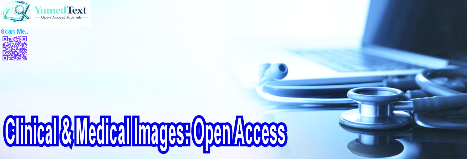 Clinical & Medical Images: Open Access